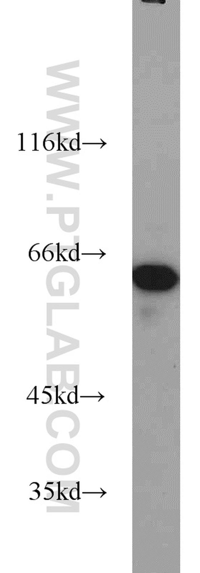 CKAP4 Antibody in Western Blot (WB)