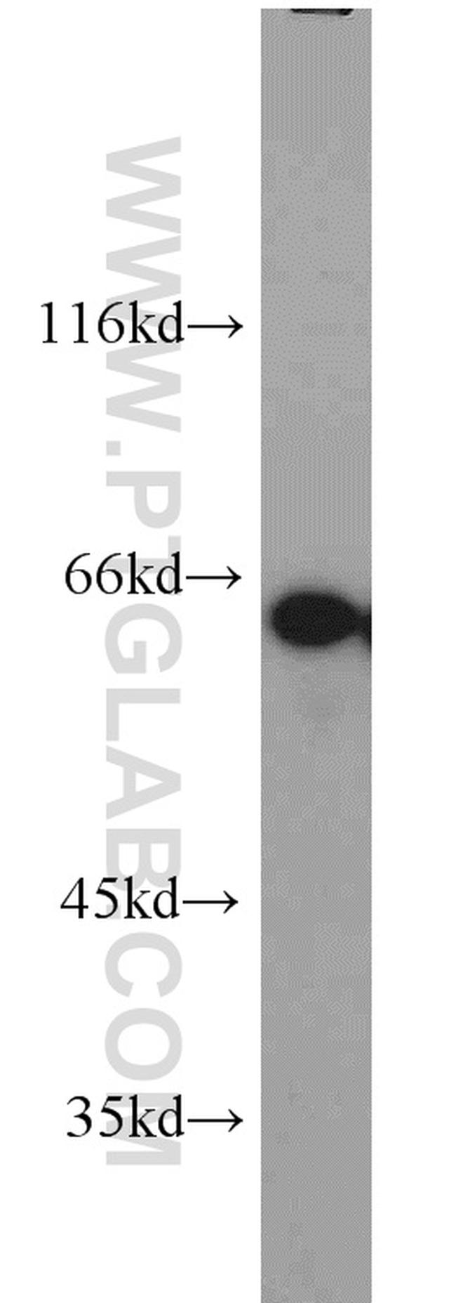 CKAP4 Antibody in Western Blot (WB)