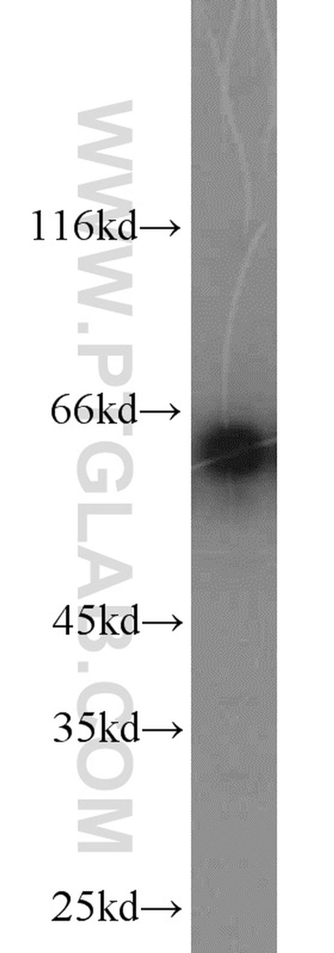 CKAP4 Antibody in Western Blot (WB)