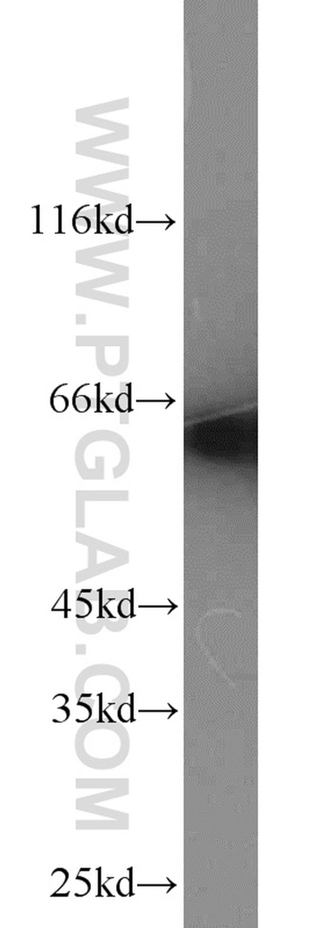 CKAP4 Antibody in Western Blot (WB)