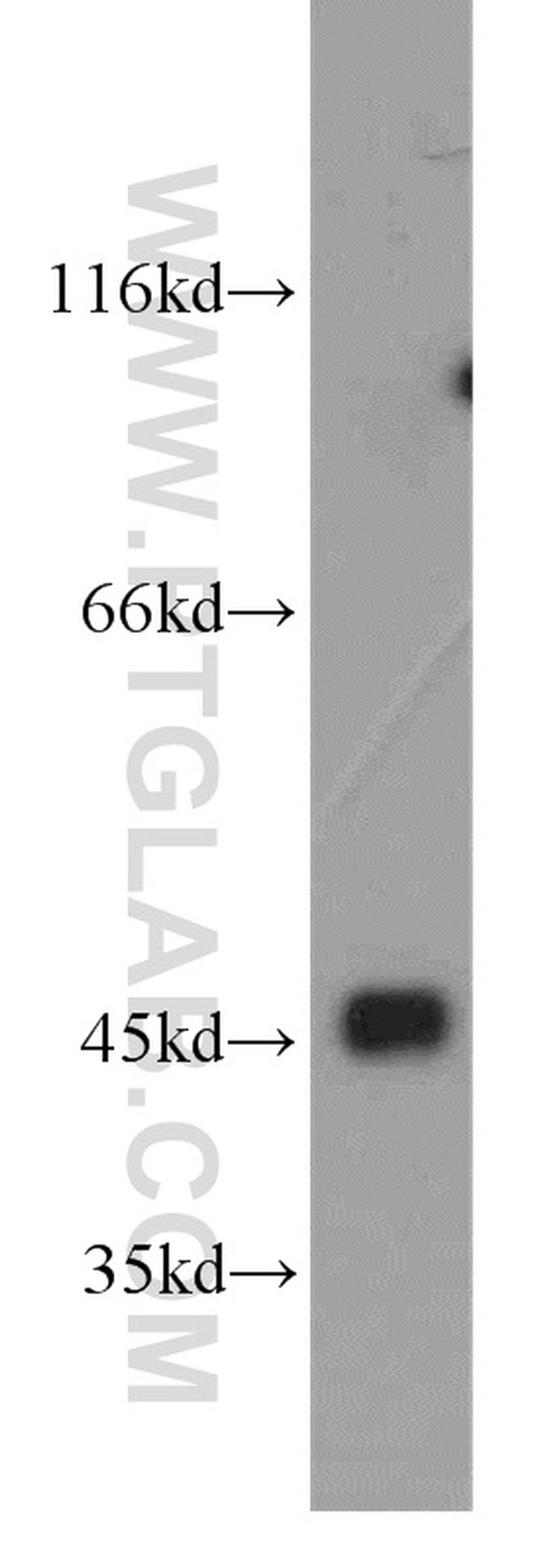 Cytohesin 3 Antibody in Western Blot (WB)