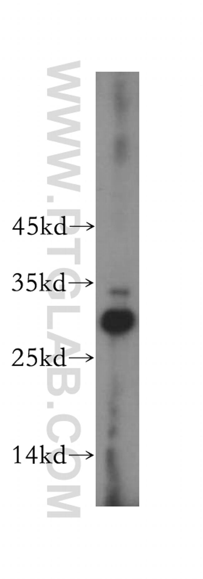 CA13 Antibody in Western Blot (WB)