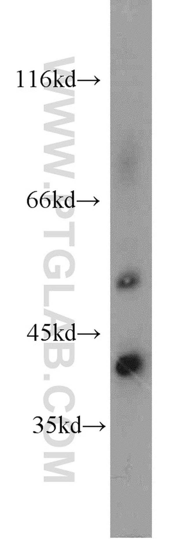 NKD2 Antibody in Western Blot (WB)