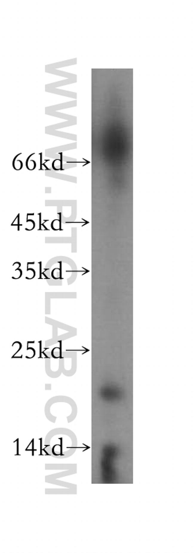 OBFC2A Antibody in Western Blot (WB)