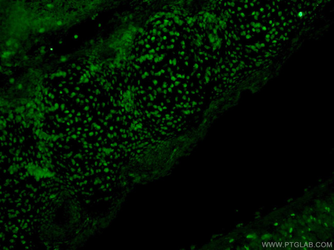 SOX15 Antibody in Immunohistochemistry (PFA fixed) (IHC (PFA))