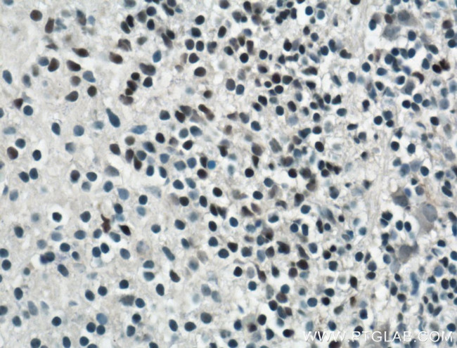 SOX15 Antibody in Immunohistochemistry (Paraffin) (IHC (P))