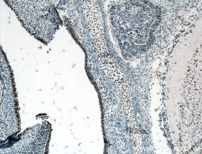 SOX15 Antibody in Immunohistochemistry (Paraffin) (IHC (P))