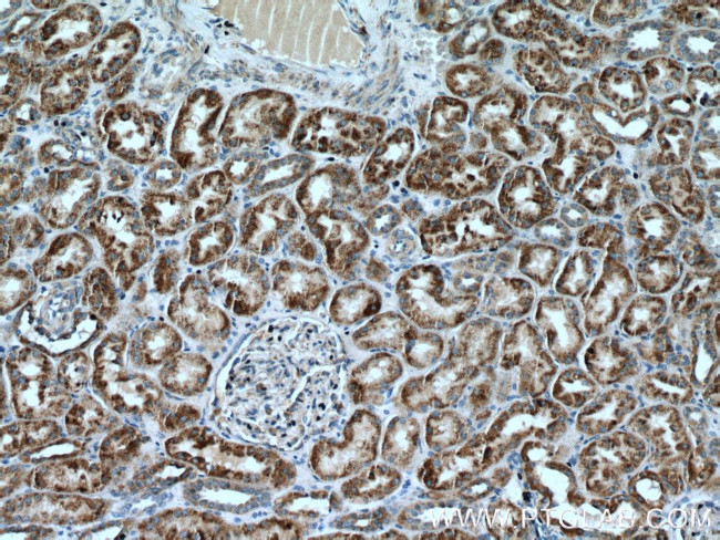 GCSH Antibody in Immunohistochemistry (Paraffin) (IHC (P))