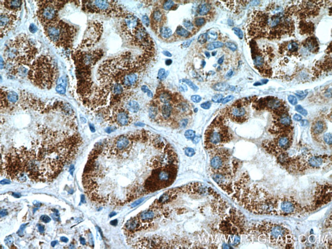 GCSH Antibody in Immunohistochemistry (Paraffin) (IHC (P))