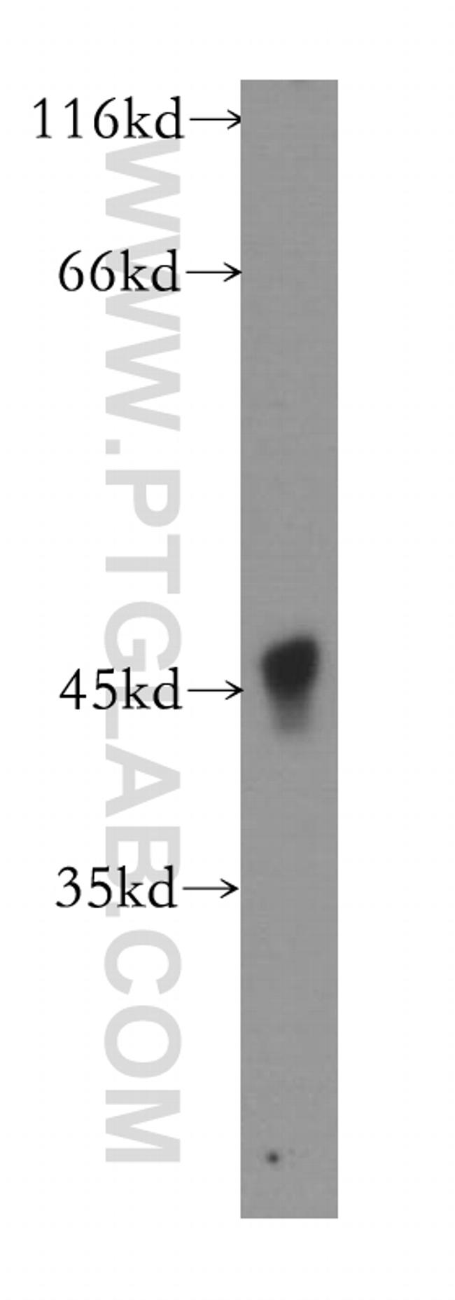 ACAD8 Antibody in Western Blot (WB)