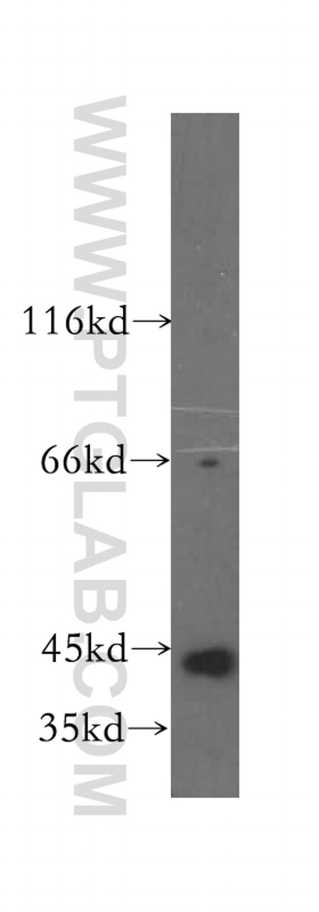 PHKG1 Antibody in Western Blot (WB)