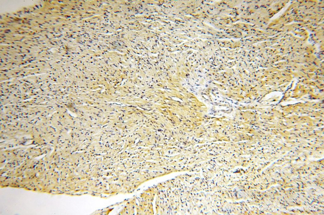 HSD17B8 Antibody in Immunohistochemistry (Paraffin) (IHC (P))