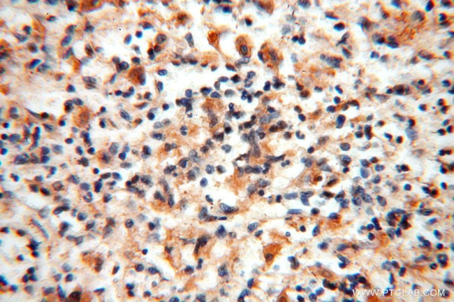 HSD17B8 Antibody in Immunohistochemistry (Paraffin) (IHC (P))