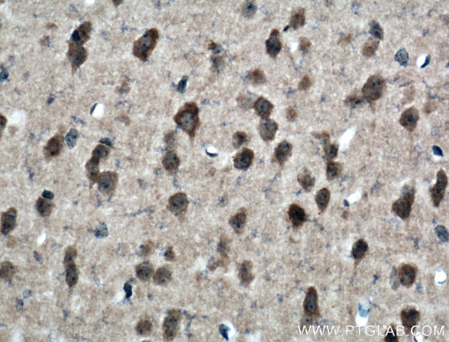 GPT2 Antibody in Immunohistochemistry (Paraffin) (IHC (P))