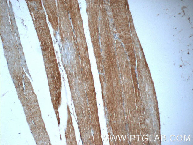 GPT2 Antibody in Immunohistochemistry (Paraffin) (IHC (P))