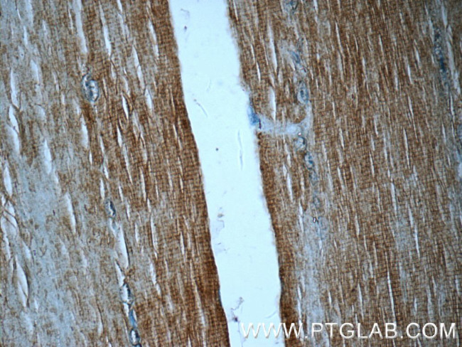 GPT2 Antibody in Immunohistochemistry (Paraffin) (IHC (P))