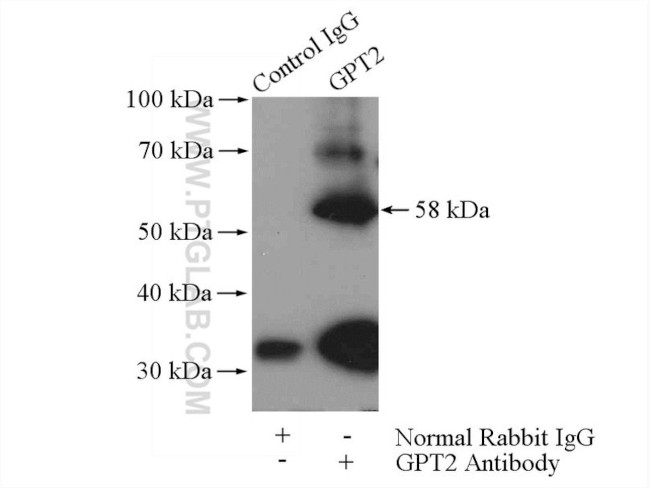 GPT2 Antibody in Immunoprecipitation (IP)