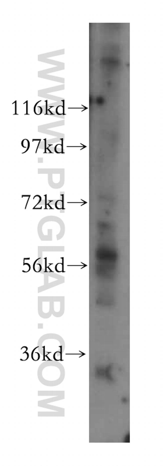 GPT2 Antibody in Western Blot (WB)