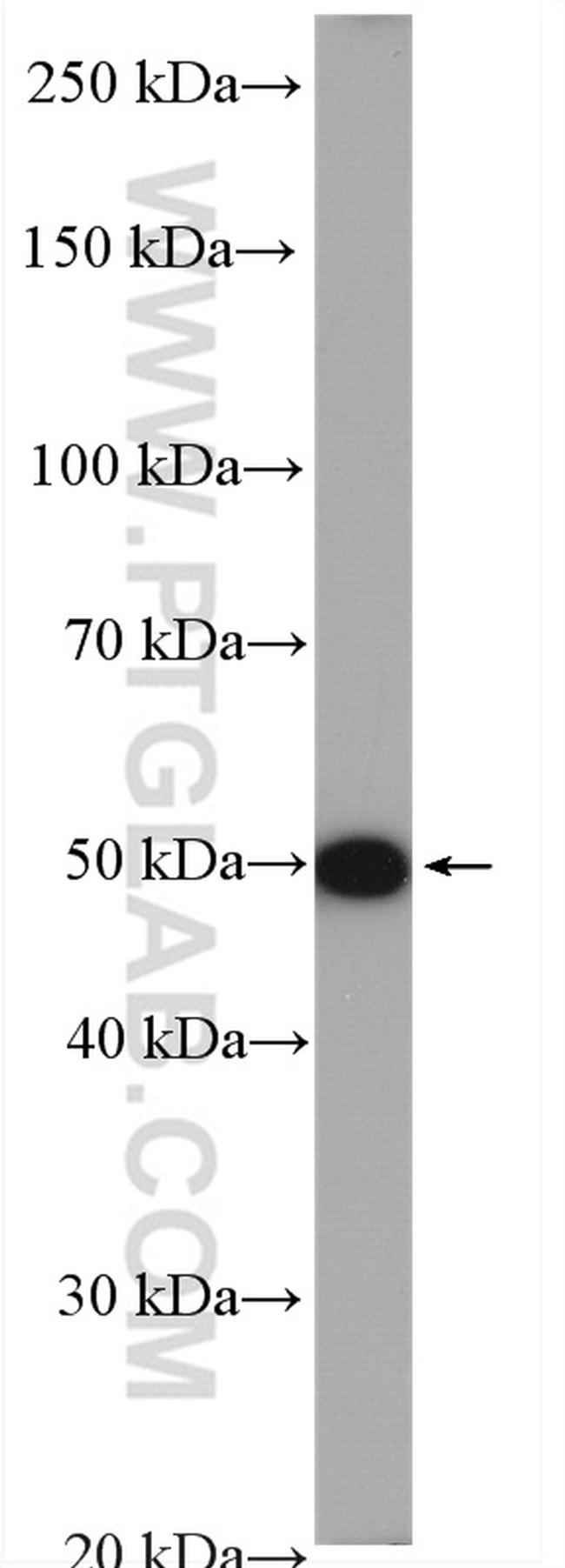 GPT2 Antibody in Western Blot (WB)