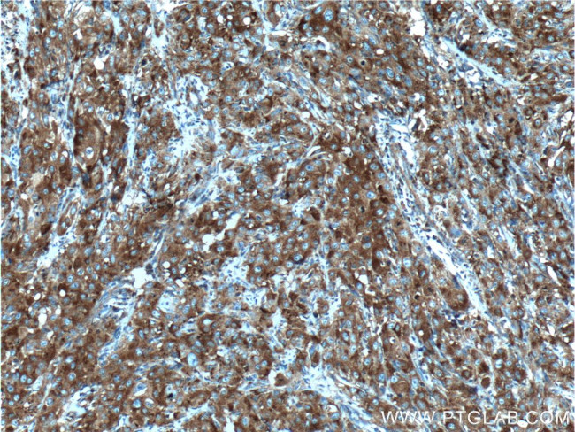 PRPSAP1 Antibody in Immunohistochemistry (Paraffin) (IHC (P))