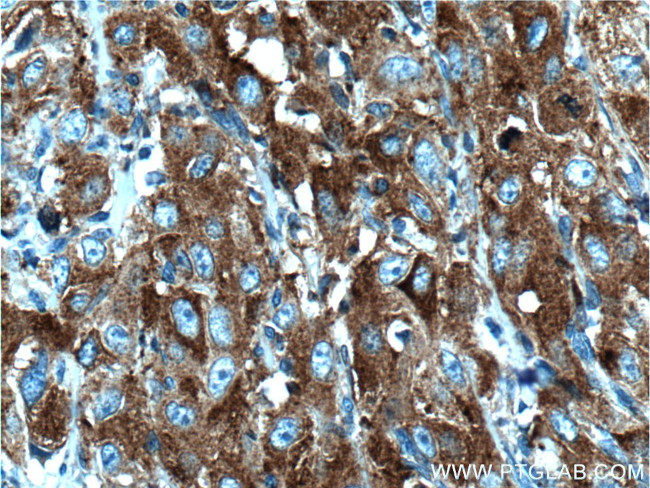 PRPSAP1 Antibody in Immunohistochemistry (Paraffin) (IHC (P))