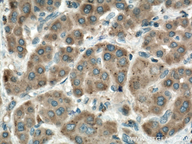PRPSAP1 Antibody in Immunohistochemistry (Paraffin) (IHC (P))