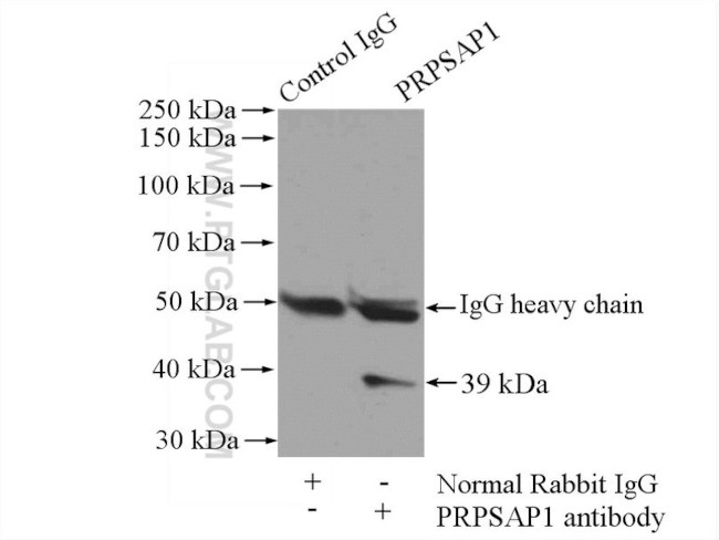 PRPSAP1 Antibody in Immunoprecipitation (IP)