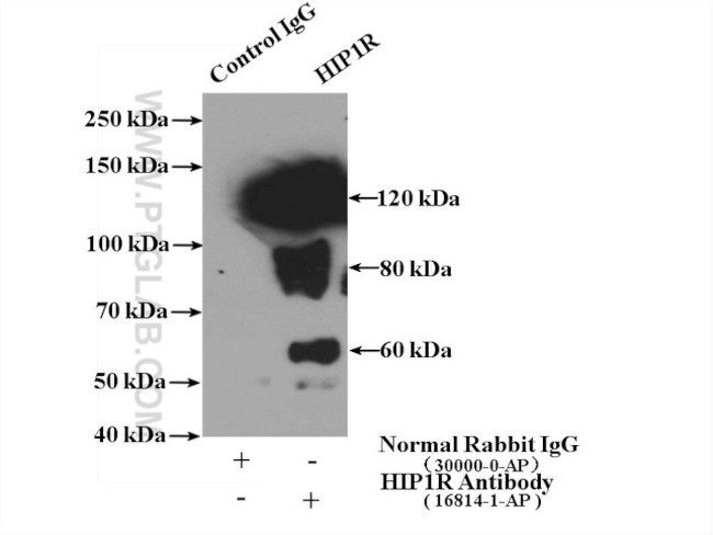 HIP1R Antibody in Immunoprecipitation (IP)