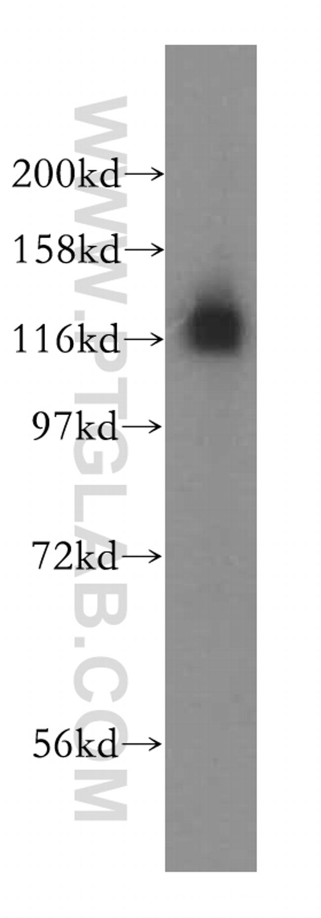 HIP1R Antibody in Western Blot (WB)