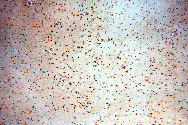 SRF Antibody in Immunohistochemistry (Paraffin) (IHC (P))