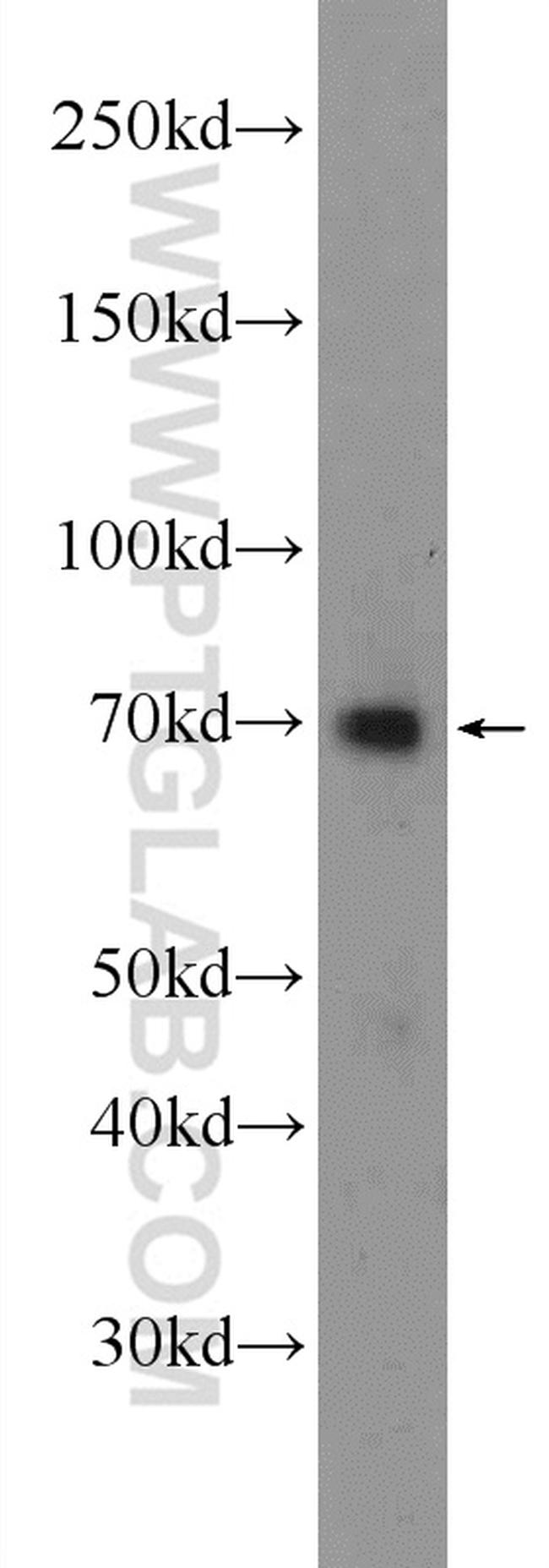 SRF Antibody in Western Blot (WB)