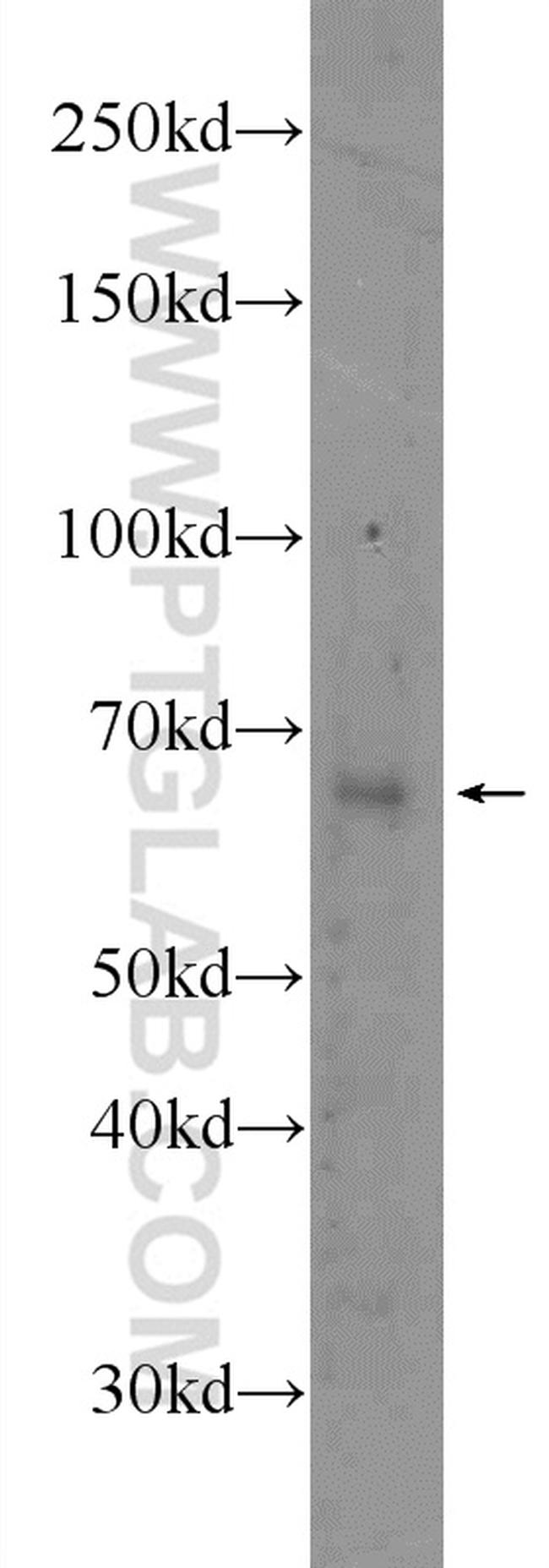 SRF Antibody in Western Blot (WB)