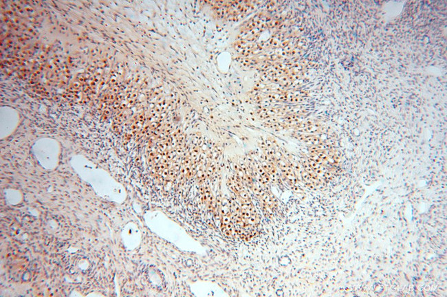 USP13 Antibody in Immunohistochemistry (Paraffin) (IHC (P))