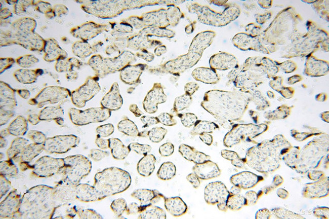 USP13 Antibody in Immunohistochemistry (Paraffin) (IHC (P))