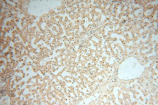 USP13 Antibody in Immunohistochemistry (Paraffin) (IHC (P))