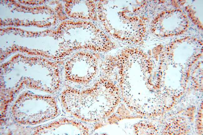 USP13 Antibody in Immunohistochemistry (Paraffin) (IHC (P))