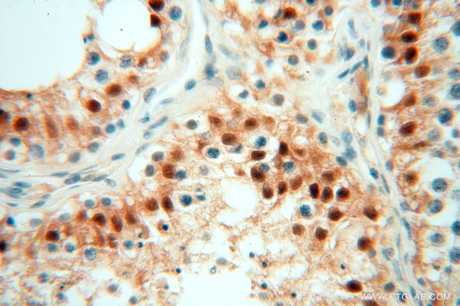 USP13 Antibody in Immunohistochemistry (Paraffin) (IHC (P))