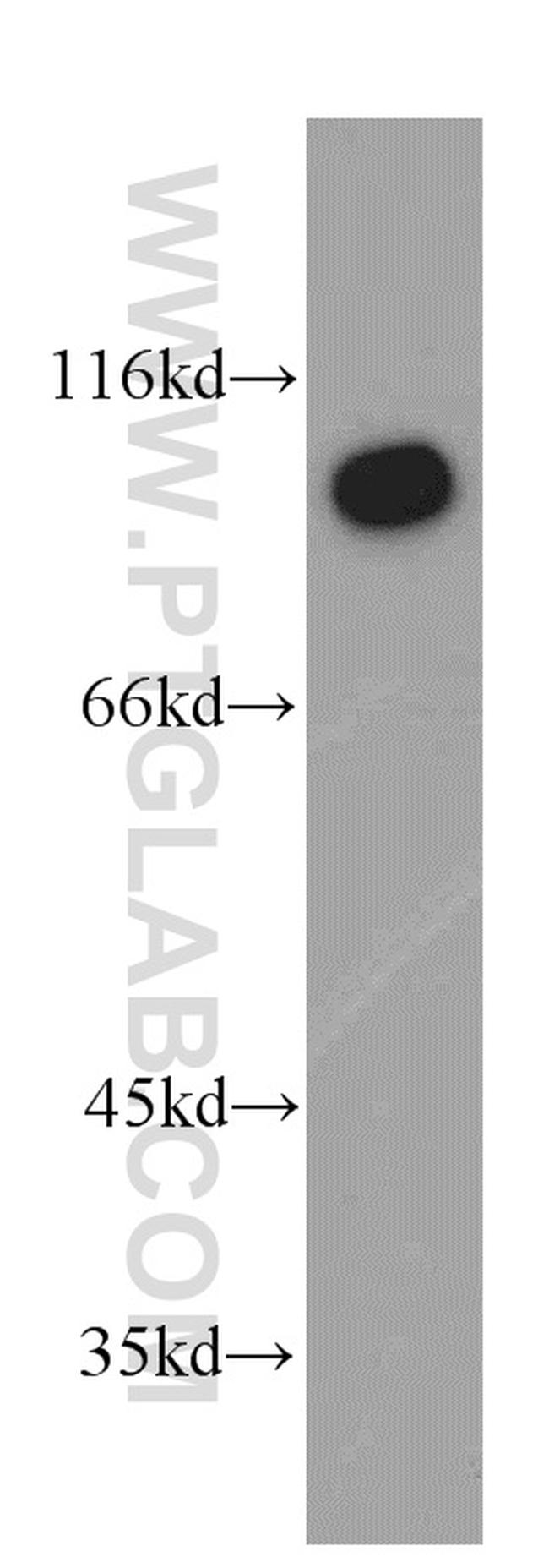 USP13 Antibody in Western Blot (WB)