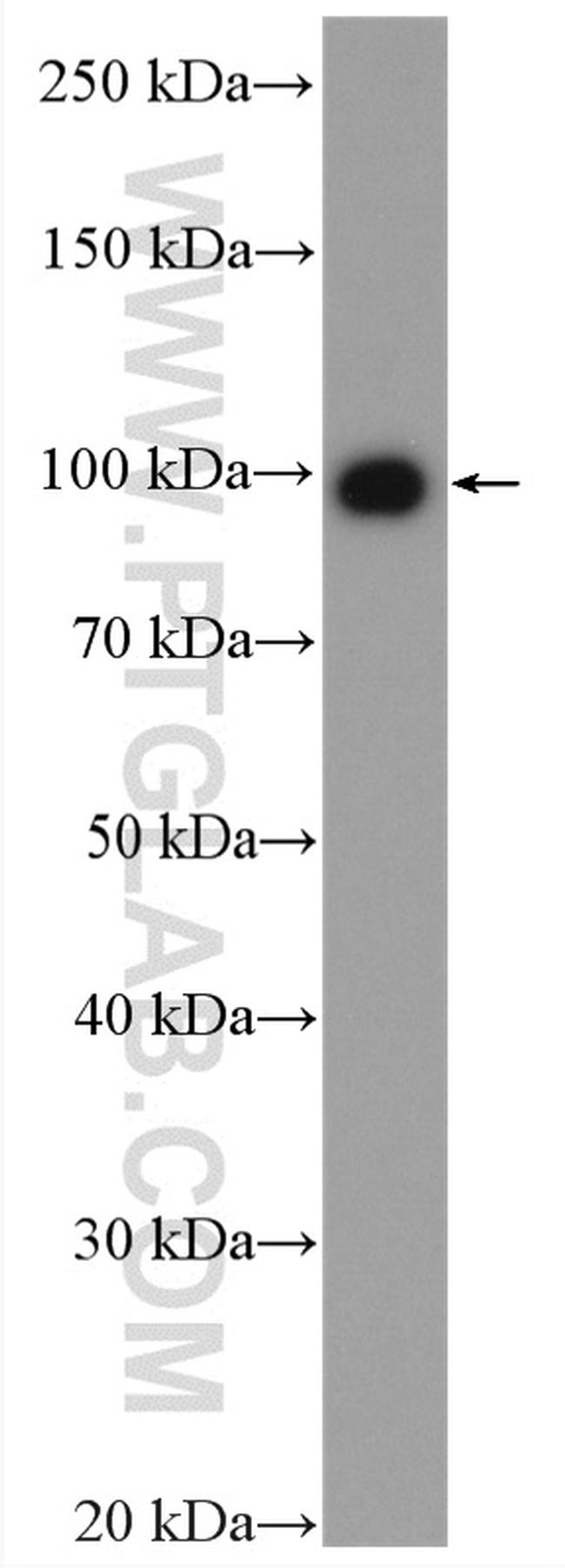 USP13 Antibody in Western Blot (WB)