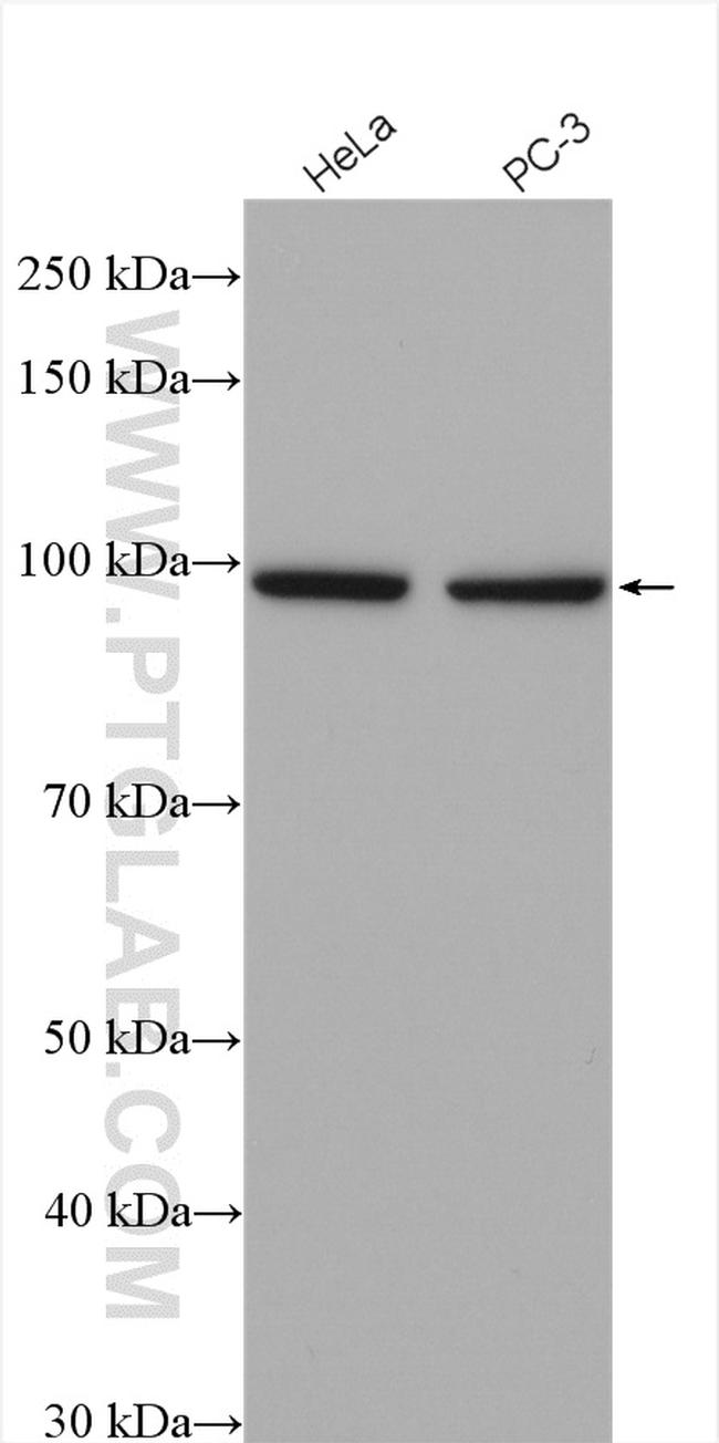 USP13 Antibody in Western Blot (WB)