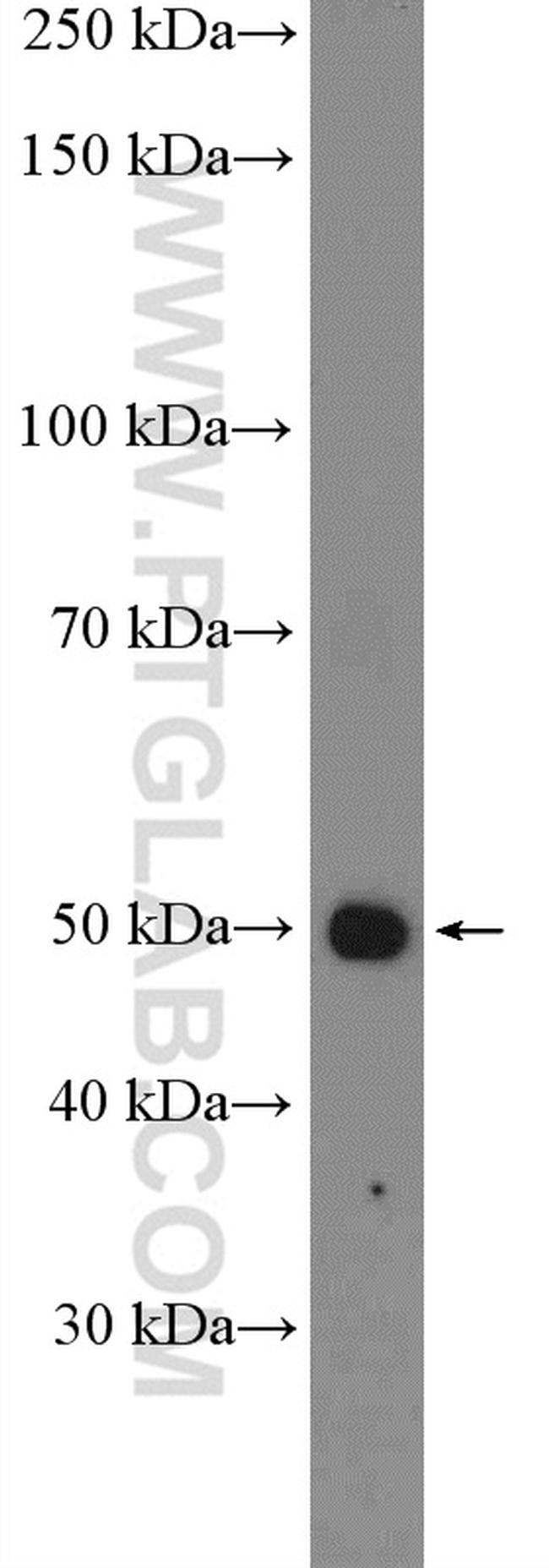 GPT Antibody in Western Blot (WB)