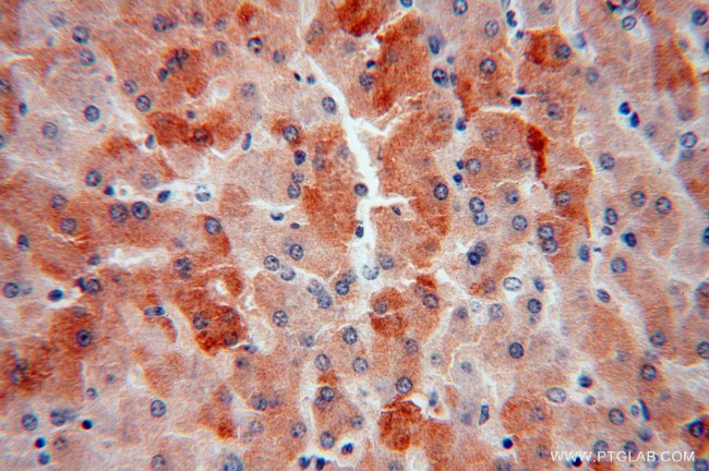 PROS1 Antibody in Immunohistochemistry (Paraffin) (IHC (P))