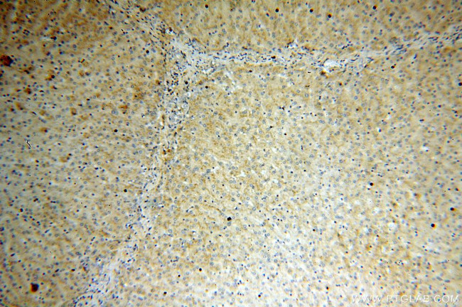 vitamin D binding protein Antibody in Immunohistochemistry (Paraffin) (IHC (P))