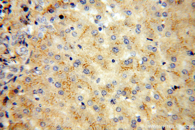 vitamin D binding protein Antibody in Immunohistochemistry (Paraffin) (IHC (P))