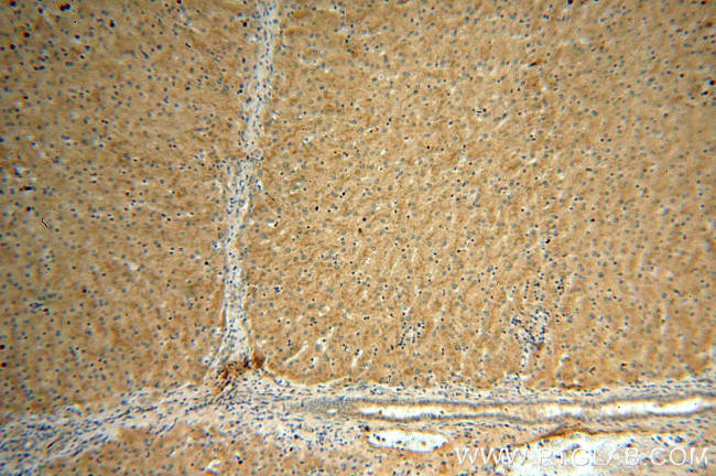 vitamin D binding protein Antibody in Immunohistochemistry (Paraffin) (IHC (P))