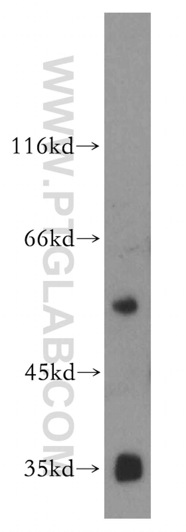 vitamin D binding protein Antibody in Western Blot (WB)