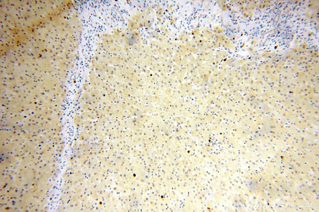 HSD17B7 Antibody in Immunohistochemistry (Paraffin) (IHC (P))