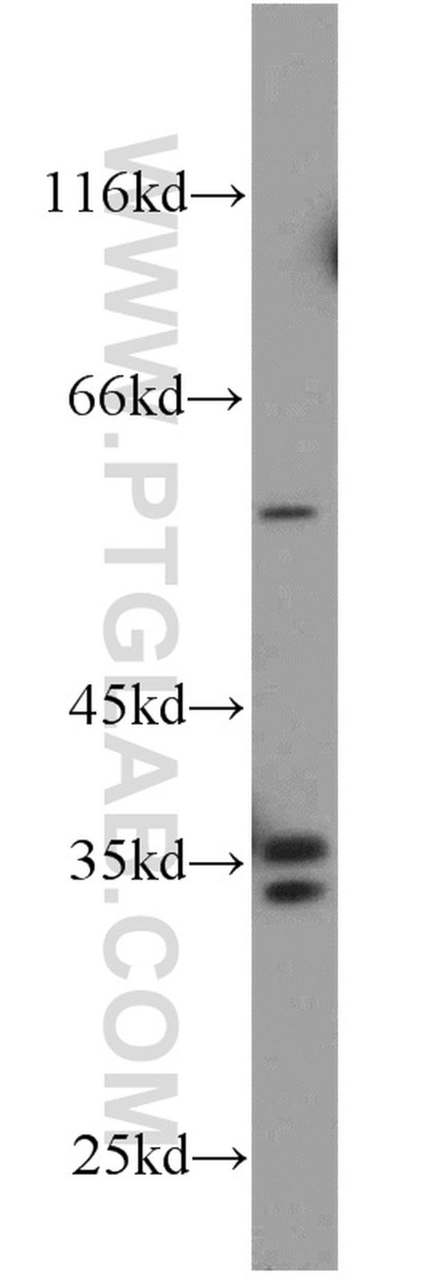 HSD17B7 Antibody in Western Blot (WB)