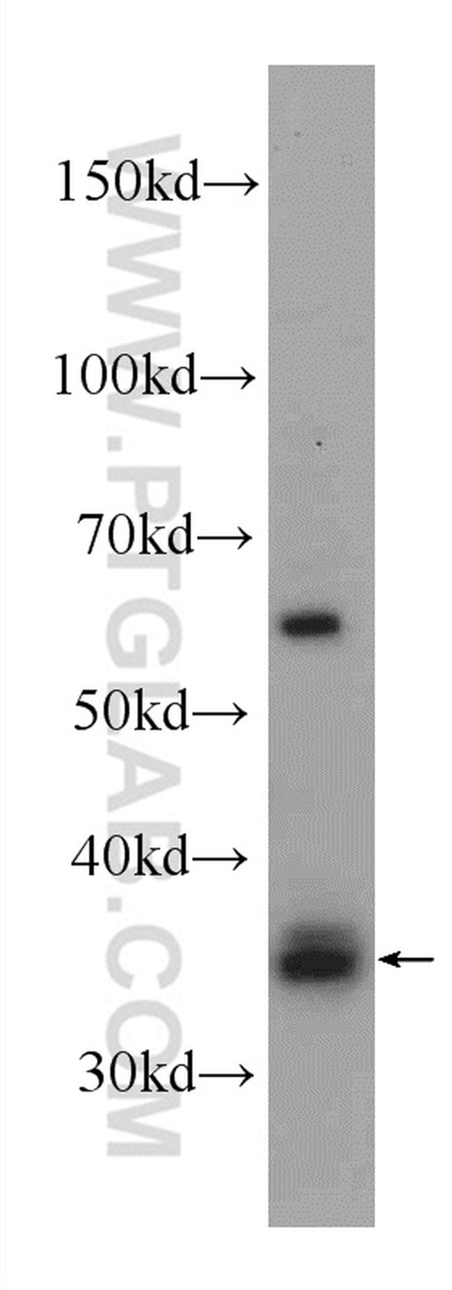 HSD17B7 Antibody in Western Blot (WB)