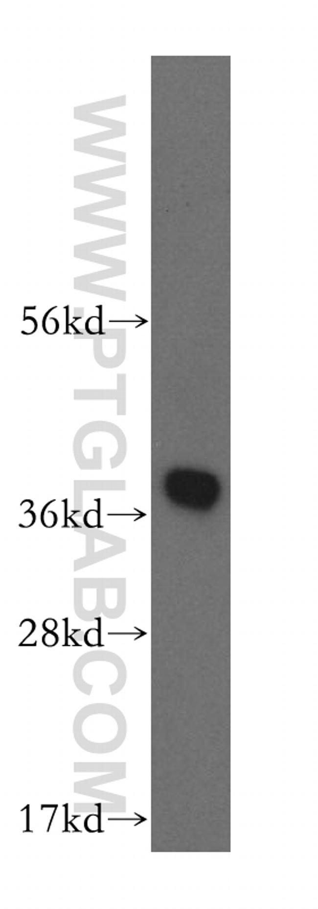 HSD17B7 Antibody in Western Blot (WB)